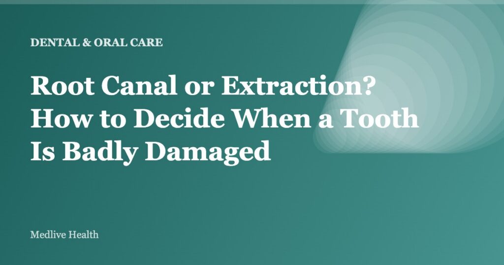 Root Canal or Extraction? How to Decide When a Tooth Is Badly Damaged