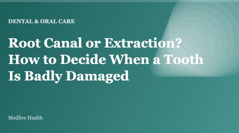 Root Canal or Extraction? How to Decide When a Tooth Is Badly Damaged