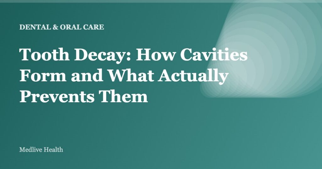 Tooth Decay: How Cavities Form and What Actually Prevents Them