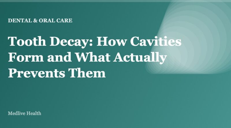 Tooth Decay: How Cavities Form and What Actually Prevents Them